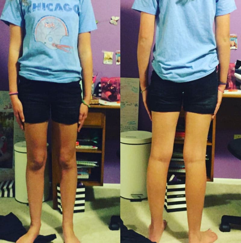 Girl wearing shorts and t-shirt