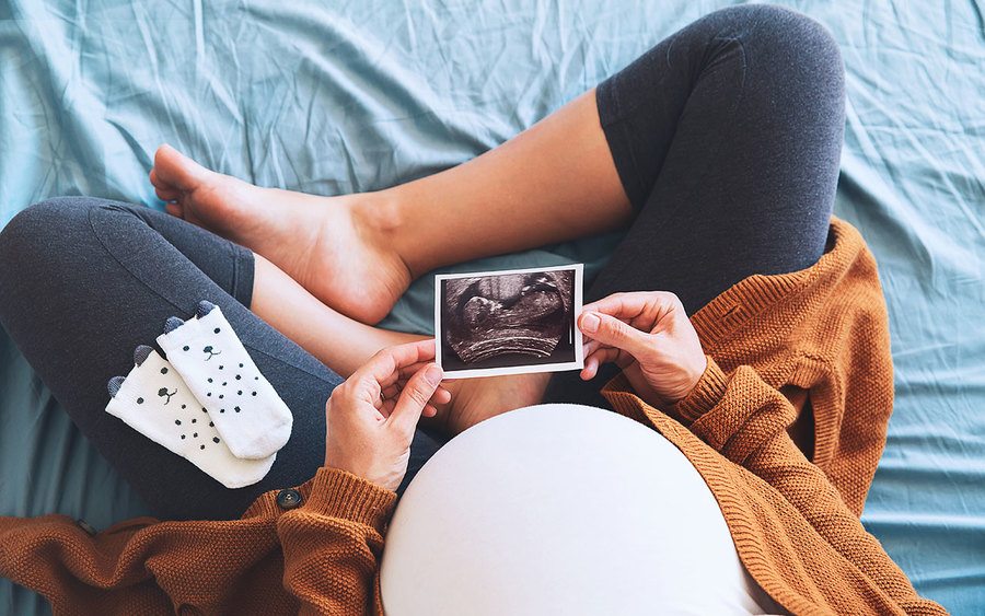 A pregnant woman holding an ultrasound