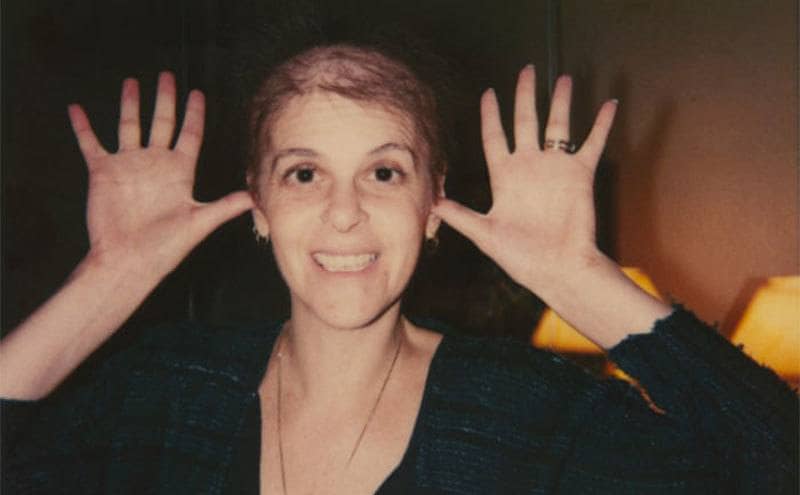 Gilda is making funny faces for the camera after most of her hair has fallen out.