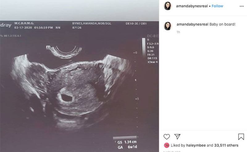 Amanda Bynes’ Instagram post of a sonogram.
