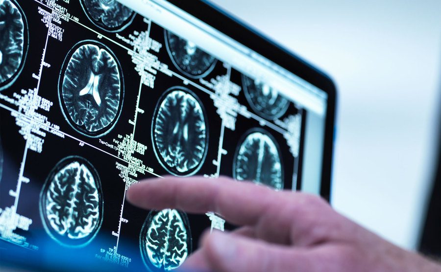 A doctor is viewing a series of MRI brain scans. 