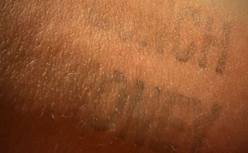 A photo of the stamp on Cayden’s arm.