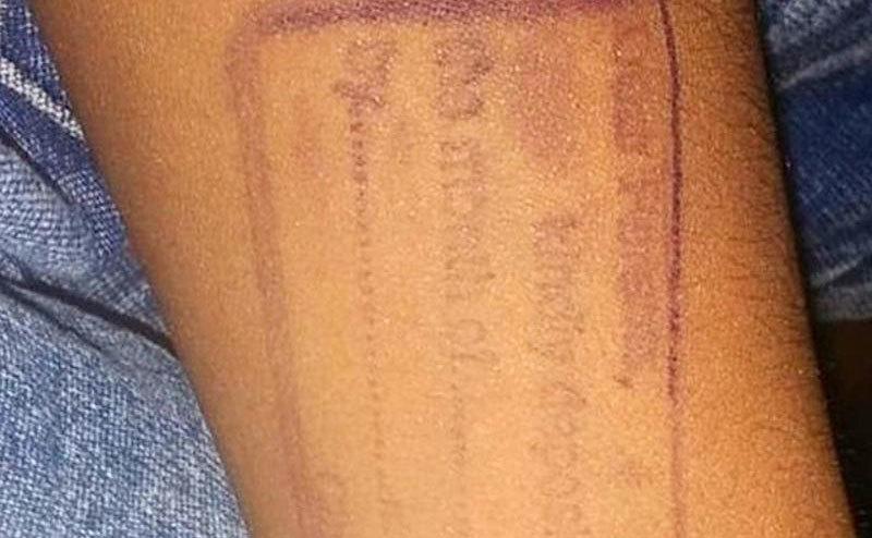 An image of a stamped arm.