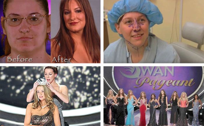 Before and after looks / A contestant before surgery / Crowning The Swan winner / The Swan Pageant
