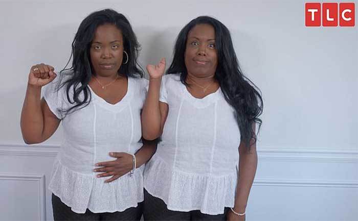 Patrix and Patrica show off their hands.