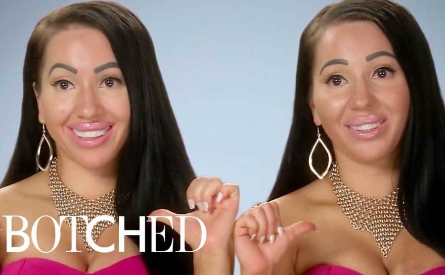 Anna and Lucy talk about their botched plastic surgery.